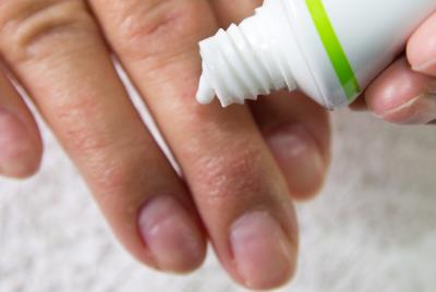 小面积皮肤损伤怎么办/巧用牙膏预防感染疗效颇佳